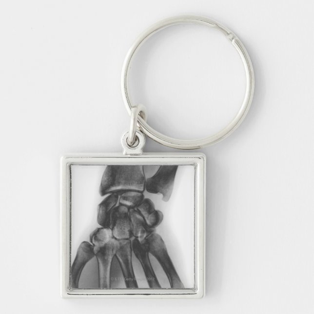 Normal wrist, X-ray Keychain (Front)
