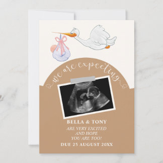 Nous Nous Attendons À Une Carte Sonogramme Brown D