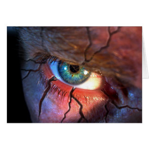 Oeil fissuré