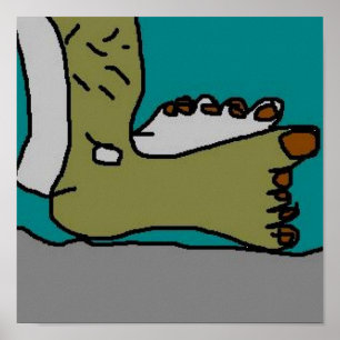 One Sunburnt Foot Poster