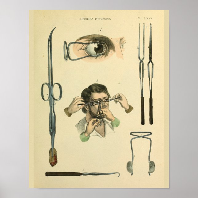 Optometry Eye Surgery Medical Art Print (Front)