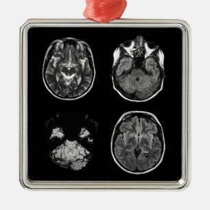 Ornement Carré Argenté Analyse IRM du cerveau