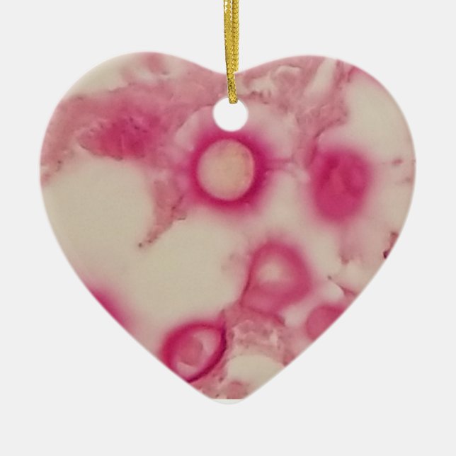 Ornement cryptococcal (Devant)