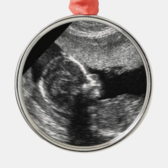 Ornement En Métal Ęr Noël du bébé (Devant)