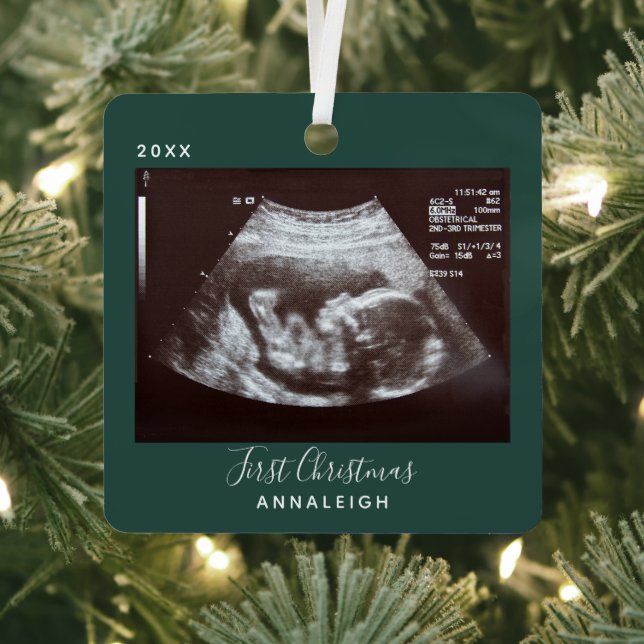 Ornement En Métal Grossesse Ultrasum Photo Premières fêtes de Noël (Insitu)