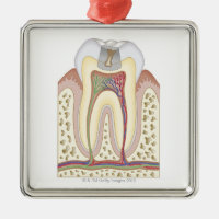 Illustration de la carie dentaire