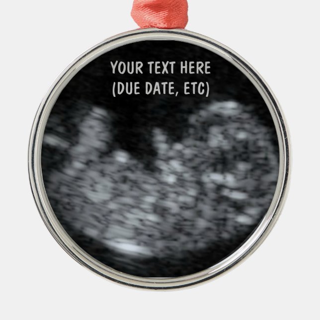 Ornement En Métal Photo personnalisée Ultrasound pour bébé (Devant)