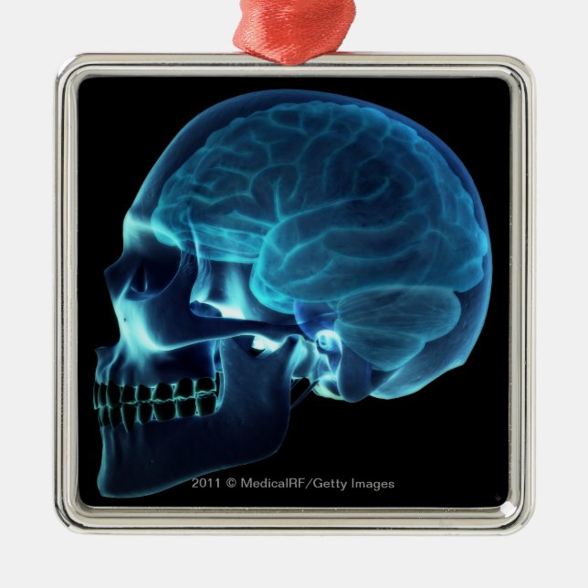 Ornement En Métal Rayon X du cerveau à l'intérieur d'un crâne (Devant)