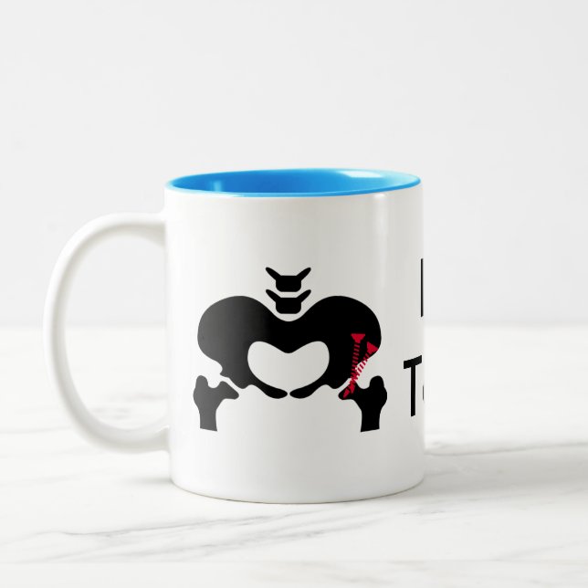 Osteotomy Peri-acétabulaire classique de tasse de (Gauche)