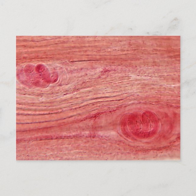 Parasite Trichinella spiralis Postcard (Front)