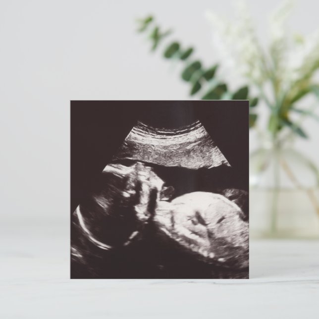 Personalized Ultrasound Picture Baby Shower  Invitation (Standing Front)