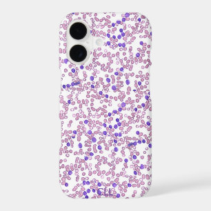 Phone case(many models)-Chronic Lymphomic Leukemia
