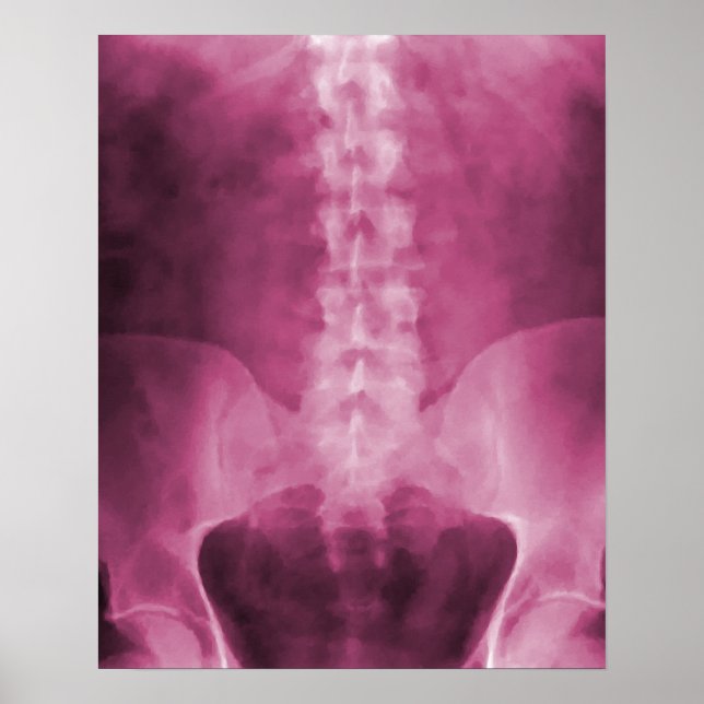 Pink Digital X-Ray Art Print (Front)
