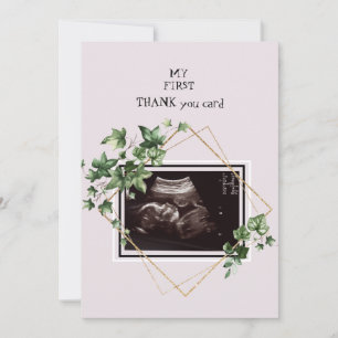Pink Ultrasound Photo Thank You Baby Point of View Card