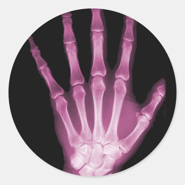Pink X-ray Skeleton Hand Classic Round Sticker (Front)