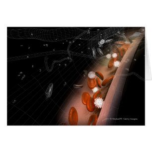 Plaque in the arteries