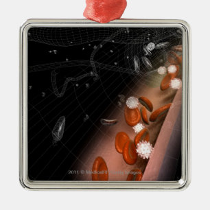 Plaque in the arteries metal ornament