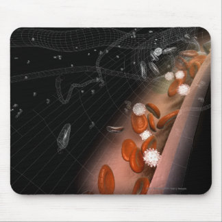 Plaque in the arteries mouse pad