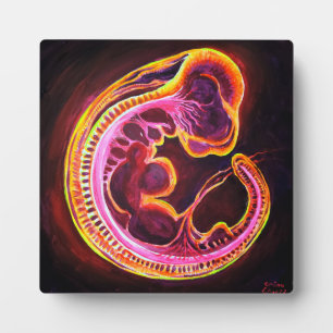 Plaque Photo Embryo
