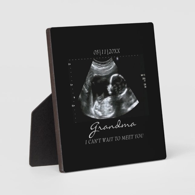 Plaque Photo Ultrasons Cadeaux pour grand-mère Sonogramme Photo (Recto)