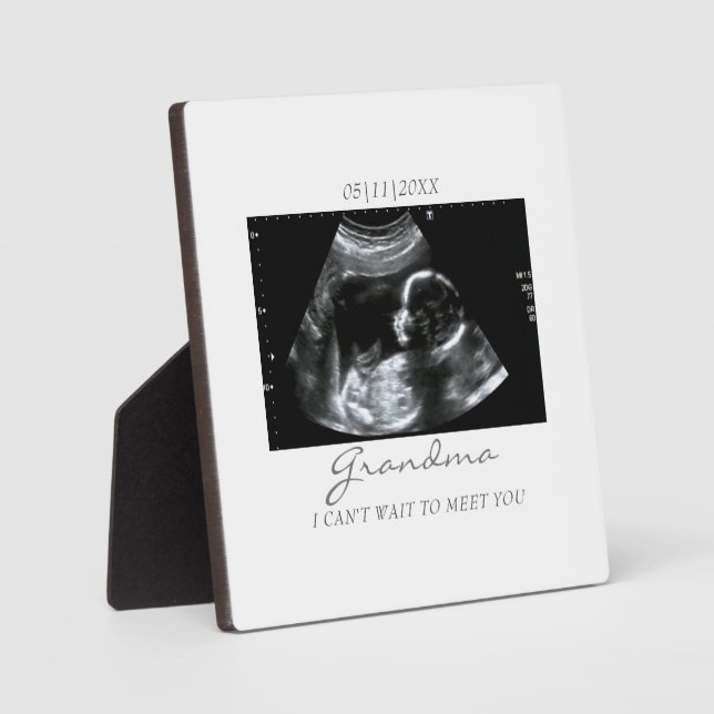 Plaque Photo Ultrasons Cadeaux pour grand-mère Sonogramme Photo (Recto)