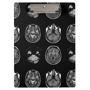 Porte-bloc Analyse IRM du cerveau
