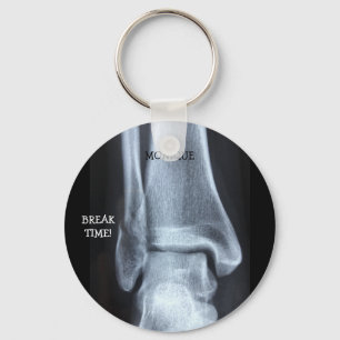 Porte-clés Funny Broken Fibula Xray "Temps de pause"