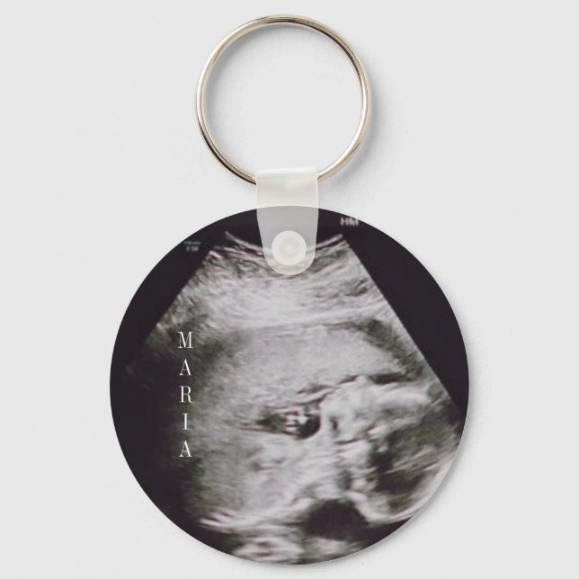 Porte-clés Porte - clé de garde de bébé Ultrasound (Recto)