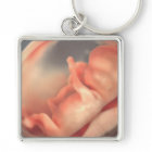 Sonogramme simple moderne Ultrasound Nouvelle phot