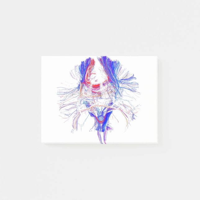 Post-it® Cerveau et Tracktography (Devant)