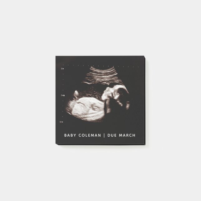 Post-it® Pregnancy Baby Sonogramme Ultrasound Photo (Devant)