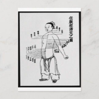 Postale Carte médicale chinoise