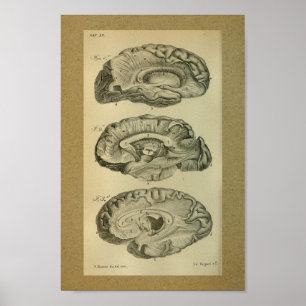 Poster 1850 lobes vintages de cerveau d'impression