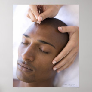 Poster Acuponcture. Acupuncteur insérant une aiguille