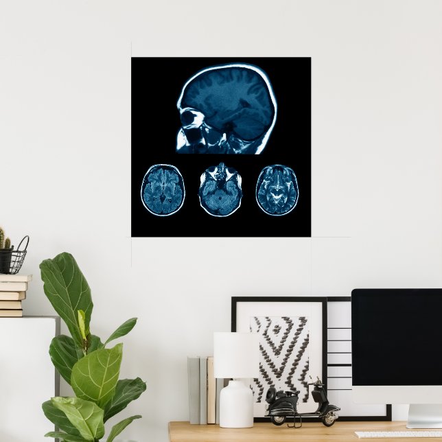 Poster Analyse Mri du cerveau (Bureau à domicile)