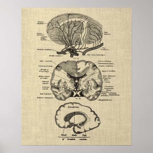 Poster Anatomie cérébrale n° 8 avec Arrière - plan de crè (Devant)