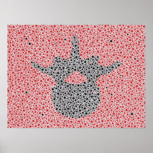 Poster Anatomie chiropratique oeuvre Lumbar Vertebrae