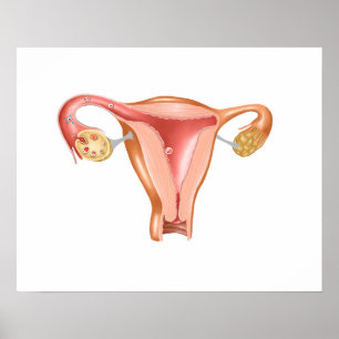 Poster Anatomie De L'Utérus Féminin 1