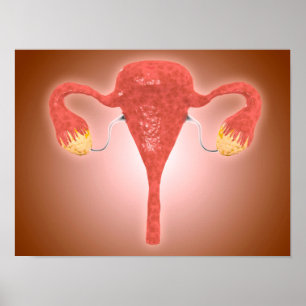 Poster Anatomie De L'Utérus Féminin Avec Ovaires