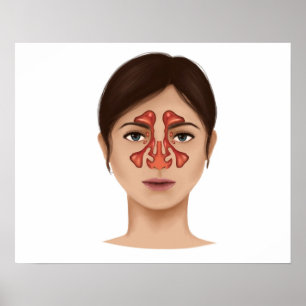 Poster Anatomie Des Sinus Nasaux