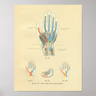 Poster Anatomie vintage de Frohse de main et de tendons