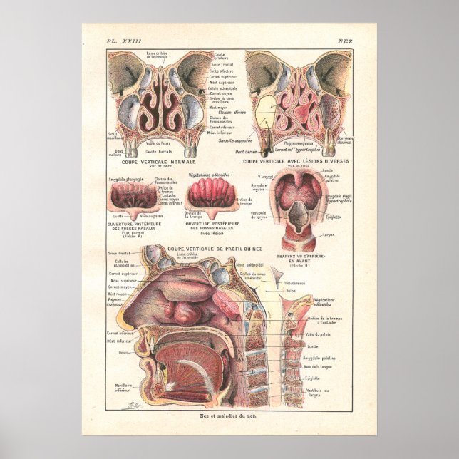 Poster anatomique du nez et du sinus en français (Devant)