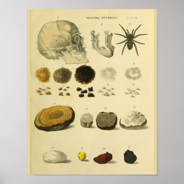 Poster Araignée de crâne humaine Anatomie Médicale Art Im (Devant)
