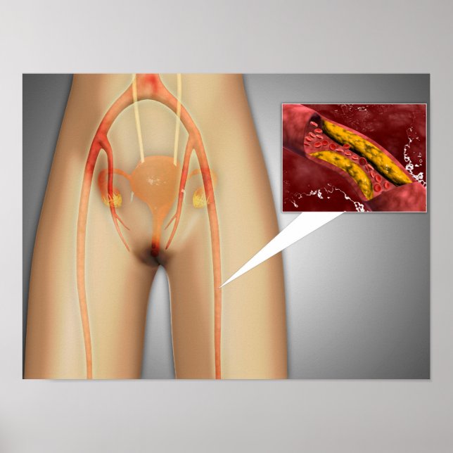 Poster Artère étroite près de la jambe Gros plan (Devant)