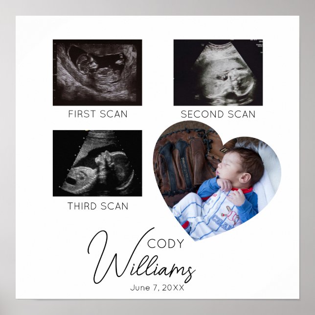 Poster Baby Scan Photo sonogramme nouveau-né gardien de b (Devant)
