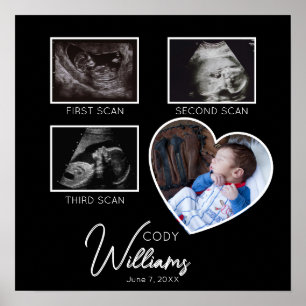 Poster Baby Scan Photo sonogramme nouveau-né gardien de b