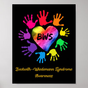 Poster Beckwith Wiedemann Syndrome Sensibilisation mains 