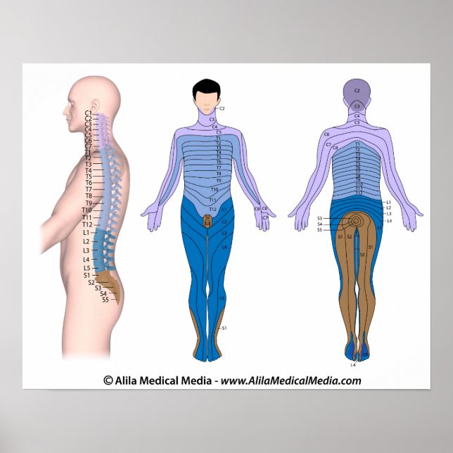 Poster Blessures à la moelle épinière, dessin médical. (Devant)