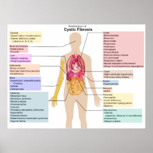 Poster Carte détaillée des symptômes de la fibrose kystiq
