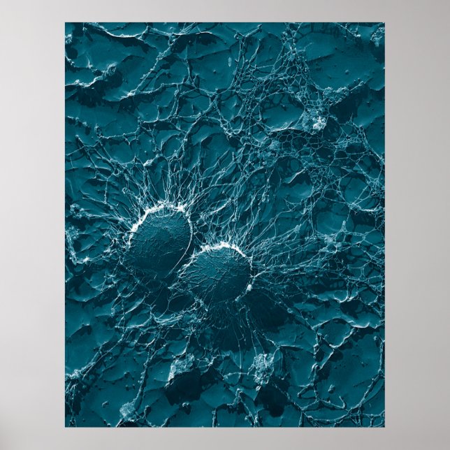 Poster Cellules bactériennes de Staphylococcus Aureus Gro (Devant)